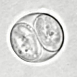 T_gondii_oocyst_sporu.jpg