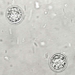 T_gondii_oocyst_upsporu.jpg