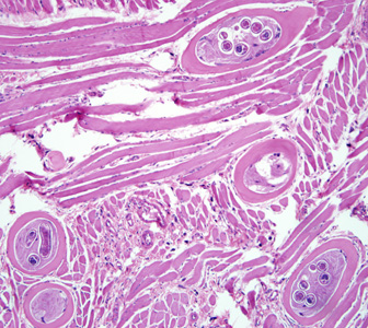 Trichinella_BAM1.jpg