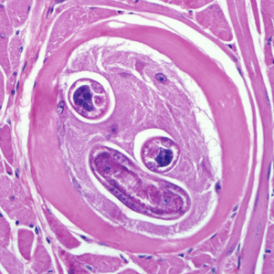 Trichinella_BAM2.jpg