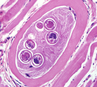 Trichinella_BAM3.jpg