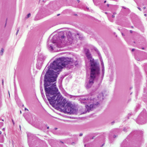 Trichinella_BAM4.jpg