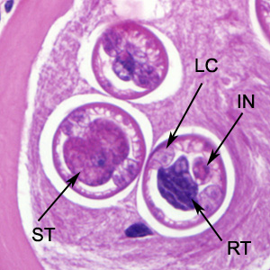 Trichinella_BAM5b.jpg