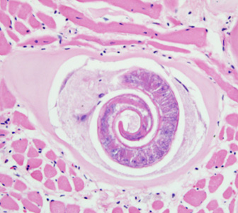 Trichinella_rat_BAM1.jpg