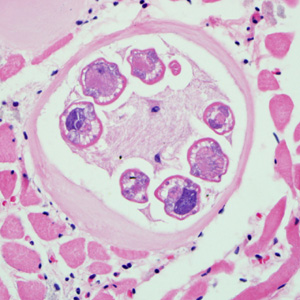 Trichinella_rat_BAM2.jpg