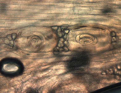 Trichinella_HBa.jpg