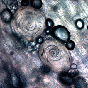 Trichinella_HBc.jpg