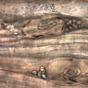 Trichinella_HBd.jpg