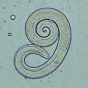 Trichinella_larvaeF.jpg