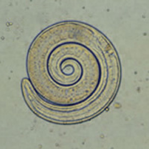 Trichinella_larvaeG.jpg
