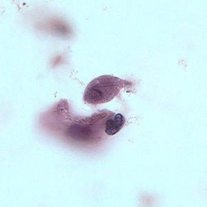 T_vaginalis_troph_BAM1.jpg