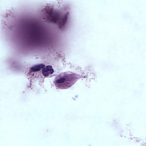 T_vaginalis_troph_BAM2.jpg
