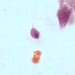 T_vaginalis_troph_BAM5.jpg