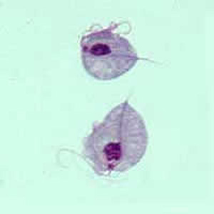 Trichomonas_trophA.jpg