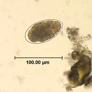 Trichostrongylus_egg_wtmt_HB2.jpg