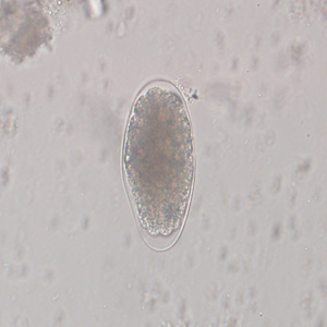 Trichostrongylus_egg_wtmt_IN1.jpg