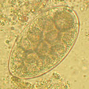 Trichostrongylus_Netherlands_A.jpg