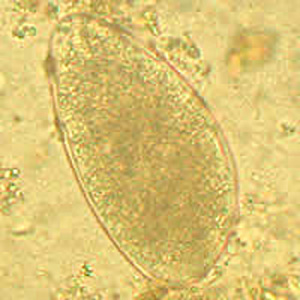 Trichostrongylus_Netherlands_B.jpg