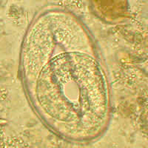 Trichostrongylus_Netherlands_C.jpg