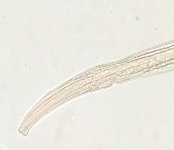 Trichostrongylus_female_anterior_200x.jpg
