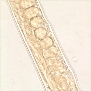 Trichostrongylus_female_midsection_200x.jpg