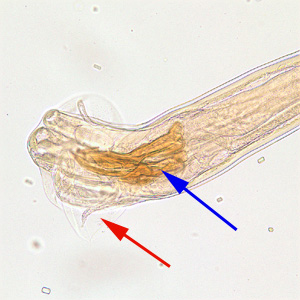 Trichostrongylus_male_posterior_200x.jpg