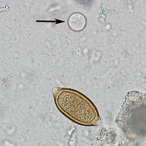 Trichuris_and_Ecoli_HB.jpg