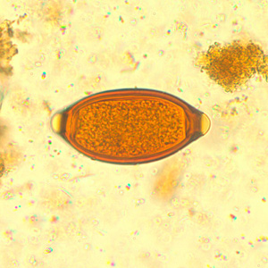 Trichuris_trichiura_egg1.jpg