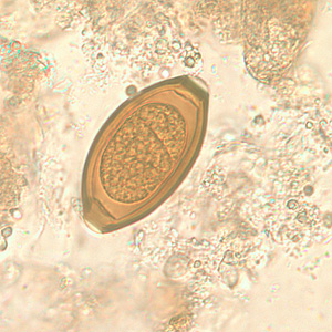 Trichuris_trichiura_egg2.jpg