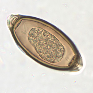 Trichuris_trichiura_egg3.jpg