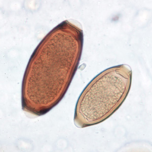 Trichuris_trichiura_egg4.jpg