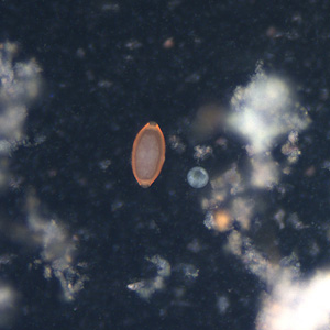 Trichuris_trichiura_egg_UV1.jpg