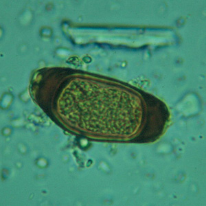 Trichuris_trichiura_egg_atypical1.jpg