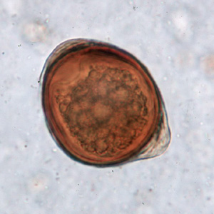 Trichuris_trichiura_egg_atypical2.jpg