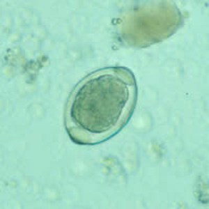 Trichuris_trichiura_egg_atypical3.jpg