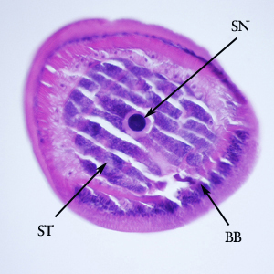 T_trichiura_CHA_C.jpg