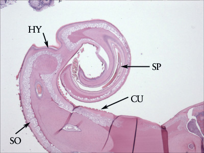 T_trichiura_tissue_HoustonVA1.jpg