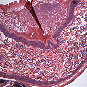Trichuris_trichiura_egg_HE_OR1.jpg