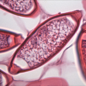 Trichuris_trichiura_egg_HE_OR4.jpg