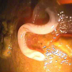 Trichuris_trichiura_adult_Duke.jpg