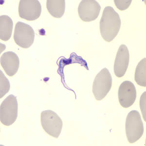 Tbrucei_thin_giemsa.jpg