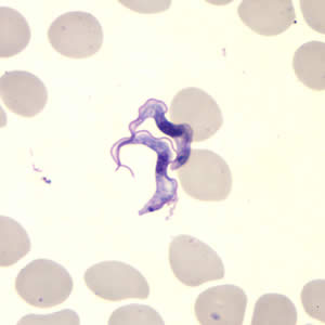 Tbrucei_thin_giemsa2.jpg