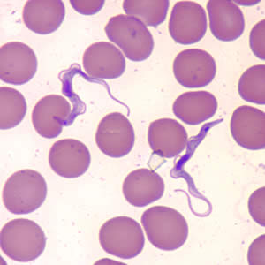 Tbrucei_thin_wrgiemsa6.jpg