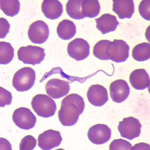 Tbrucei_thin_wrgiemsa5.jpg