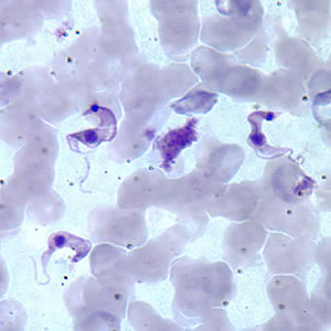 Tcruzi_thin_giemsa2.jpg