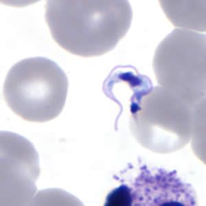 Tcruzi_thin_giemsa3_zoom.jpg