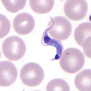 Tcruzi_thin_giemsa5_zoom.jpg