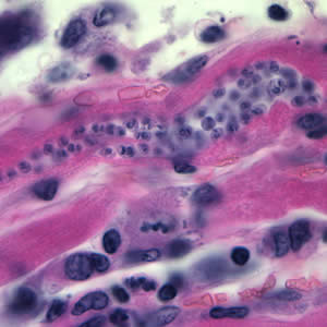 Tcruzi_tissue_he.jpg