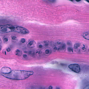 Tcruzi_tissue_he2_zoom.jpg