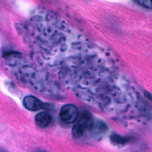 Tcruzi_tissue_he3_zoom.jpg